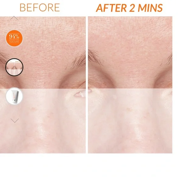 🆕Kate Somerville Exfolikate Treatment - Picture 2 of 3